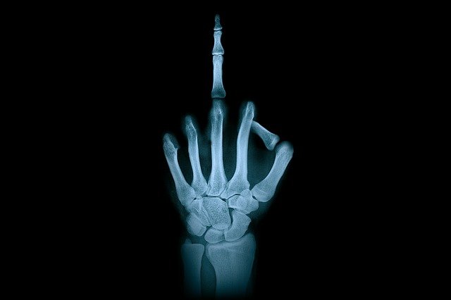 X-Ray Astronomy: Undersöka röntgenuniversumet